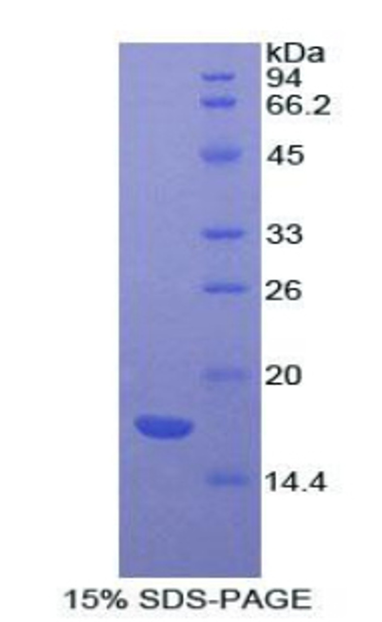 Cattle Recombinant Activin A Receptor Type II A (ACVR2A)