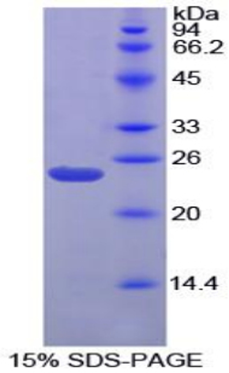 Chicken Recombinant Gremlin 1 (GREM1)