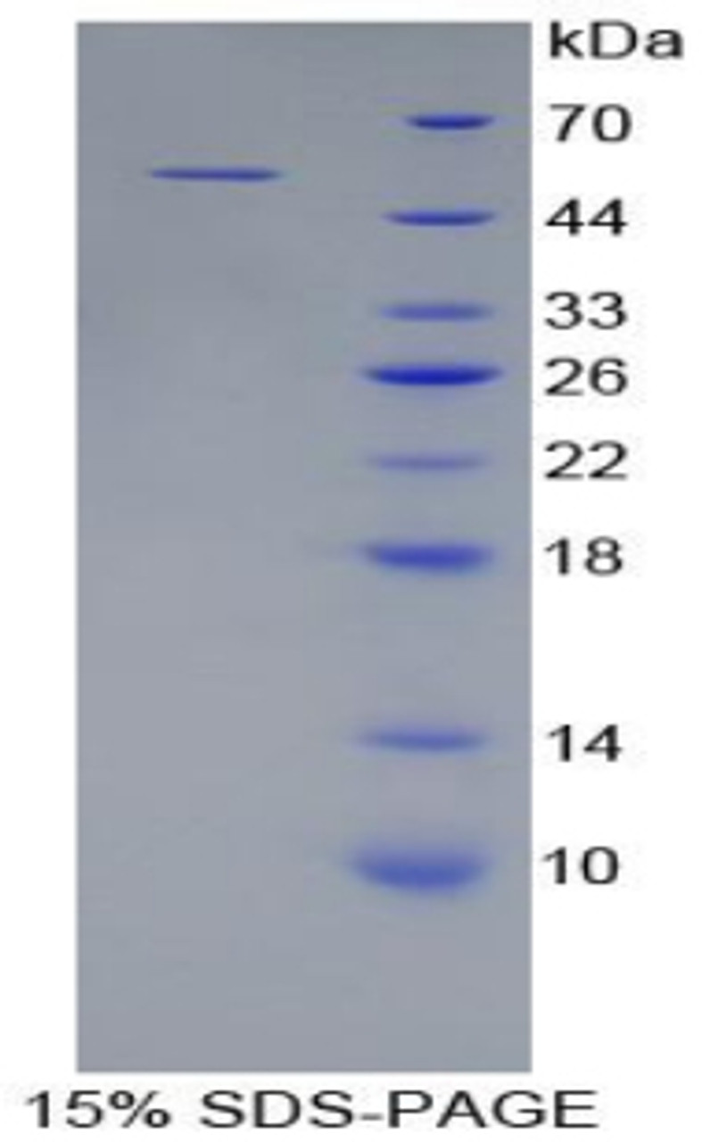 Rat Recombinant Collagen Type XVIII (COL18)