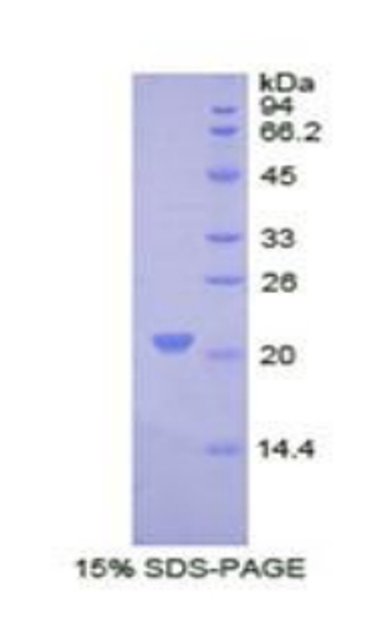 Human Recombinant Collagen Type VIII Alpha 1 (COL8a1)