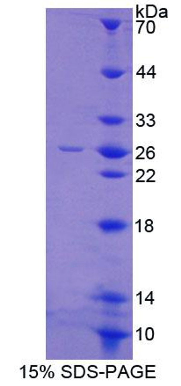 Mouse Recombinant Glial Cell Line Derived Neurotrophic Factor Receptor Alpha 2 (GFRa2)