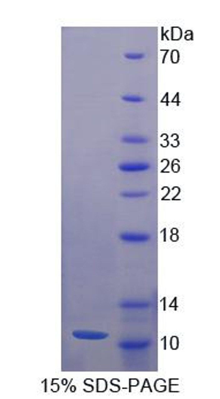 Mouse Recombinant Neuregulin 4 (NRG4)