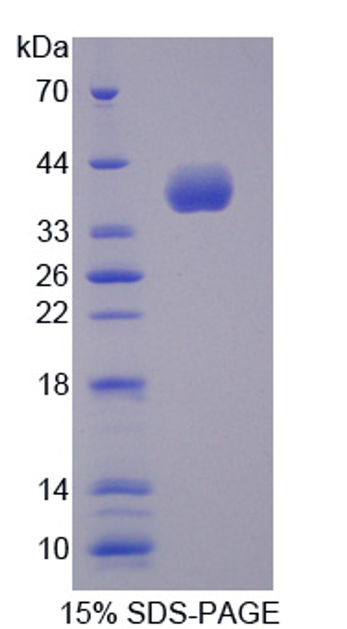 Human Recombinant Neurocan (NCAN)