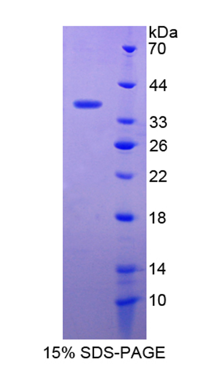 Human Recombinant Hepatocyte Growth Factor Receptor (HGFR)