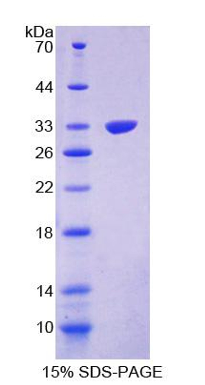 Mouse Recombinant Protein Phosphatase 1, Regulatory Subunit 15A (PPP1R15A)