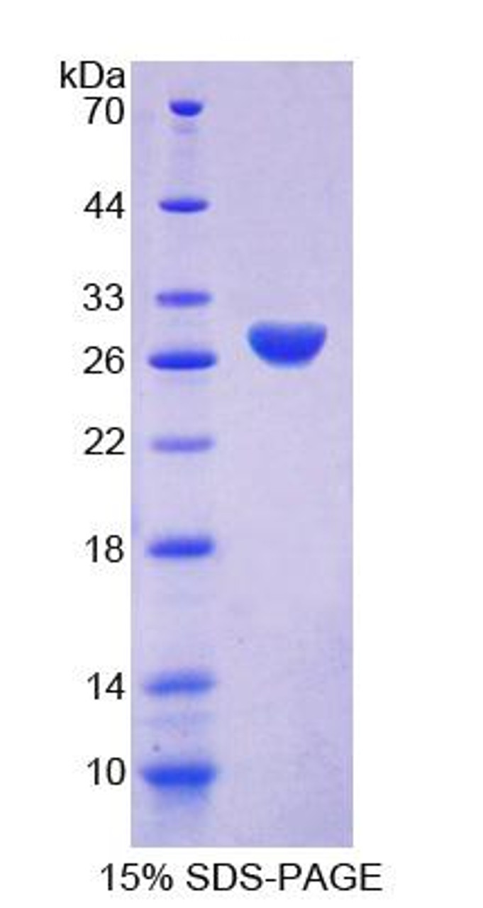 Rat Recombinant Amphiphysin (AMPH)