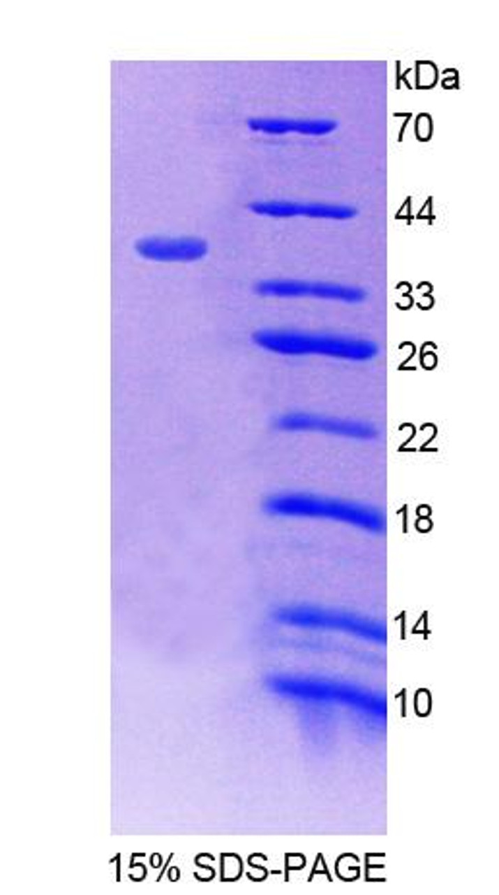 Human Recombinant Atrophin 1 (ATN1)