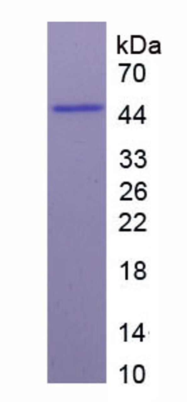 Mouse Recombinant Profilin 1 (PFN1)