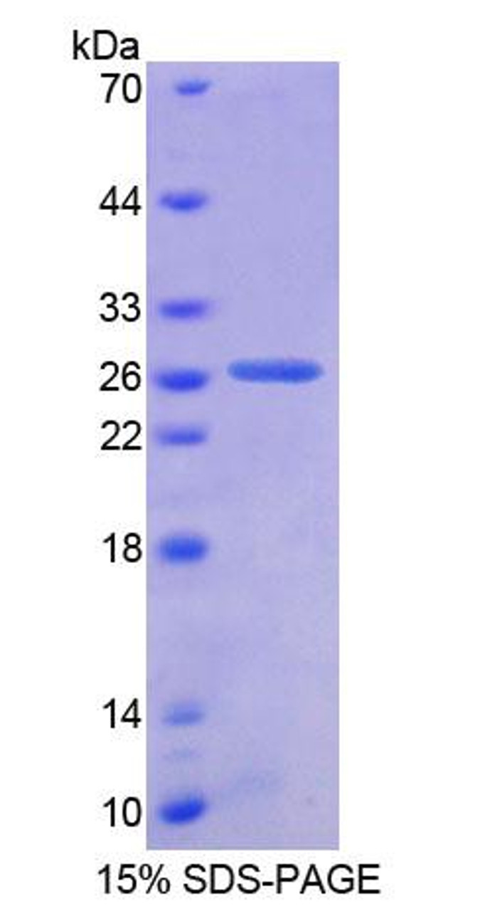 Human Recombinant Ancient Ubiquitous Protein 1 (AUP1)