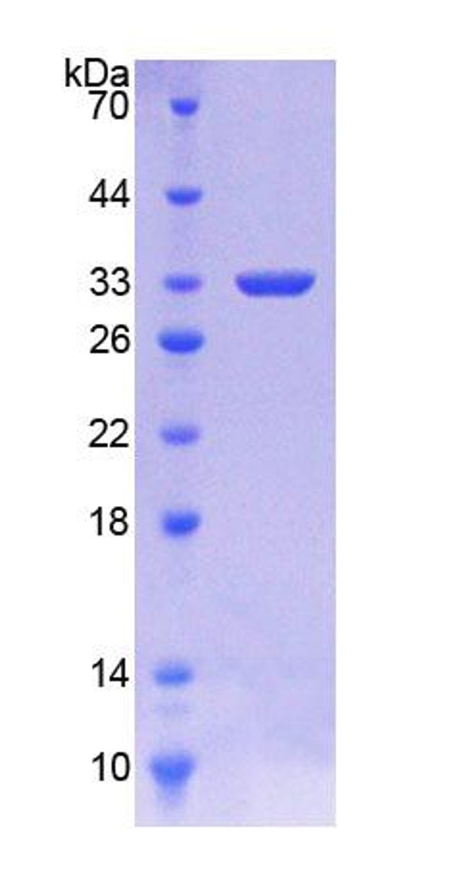 Human Recombinant Antithrombin (AT)