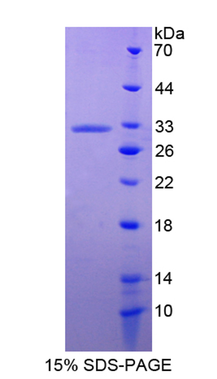 Human Recombinant Annexin A6 (ANXA6)