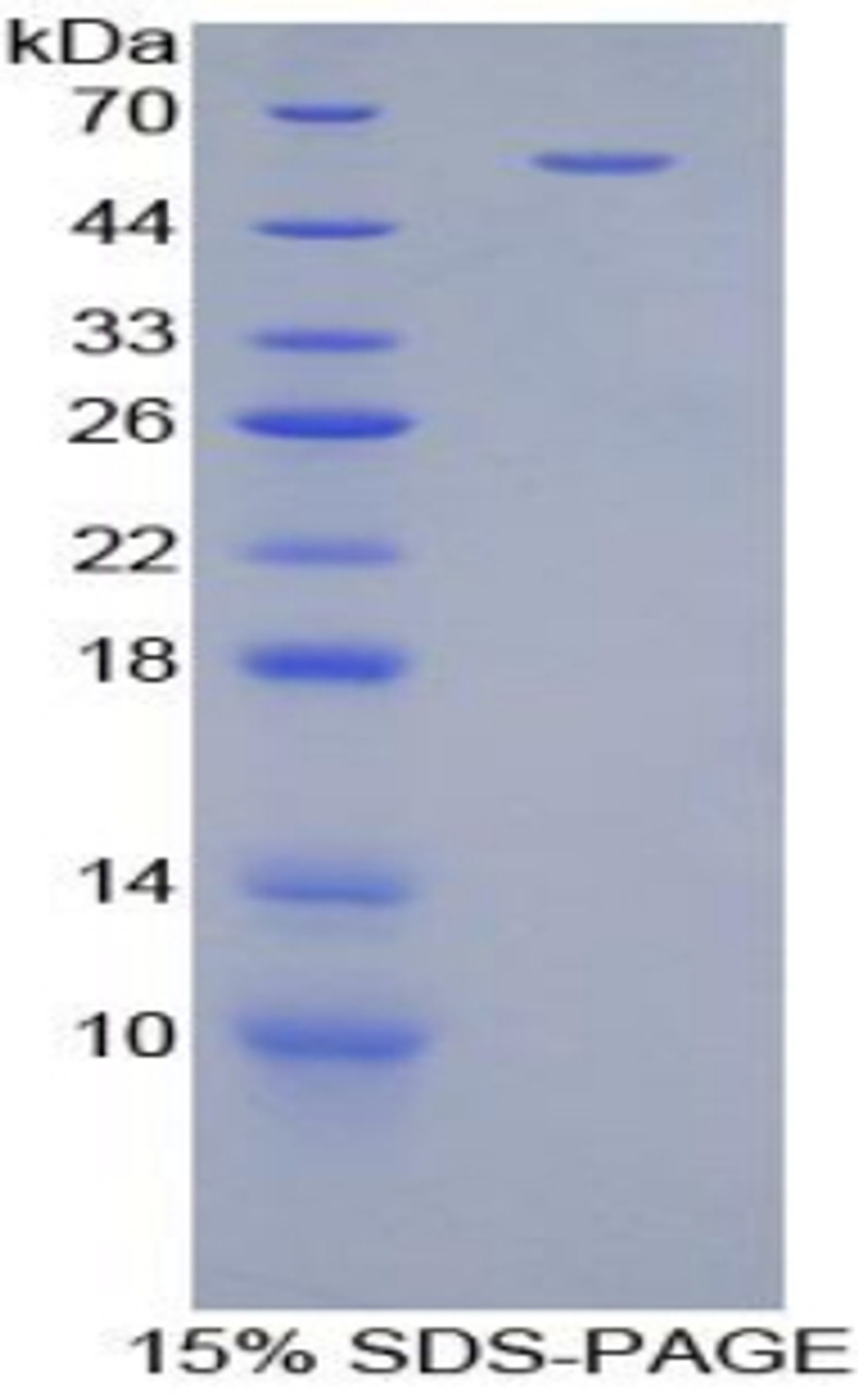 Mouse Recombinant Cartilage Intermediate Layer Protein (CILP)