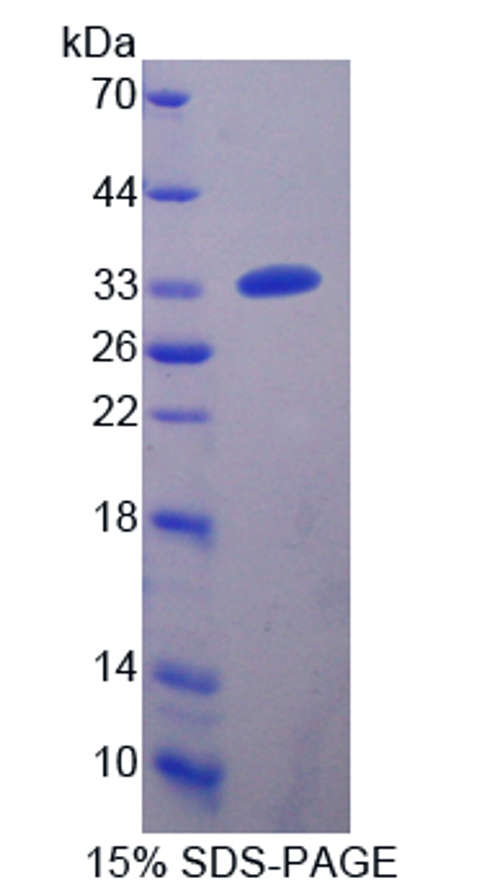 Human Recombinant Carnitine Acetyltransferase (CRAT)