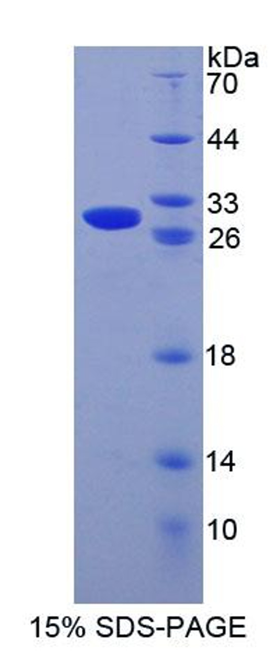 Mouse Recombinant Cysteine Rich Secretory Protein 1 (CRISP1)