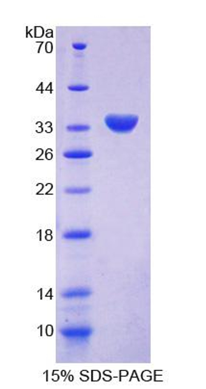 Human Recombinant Chimerin 2 (CHN2)