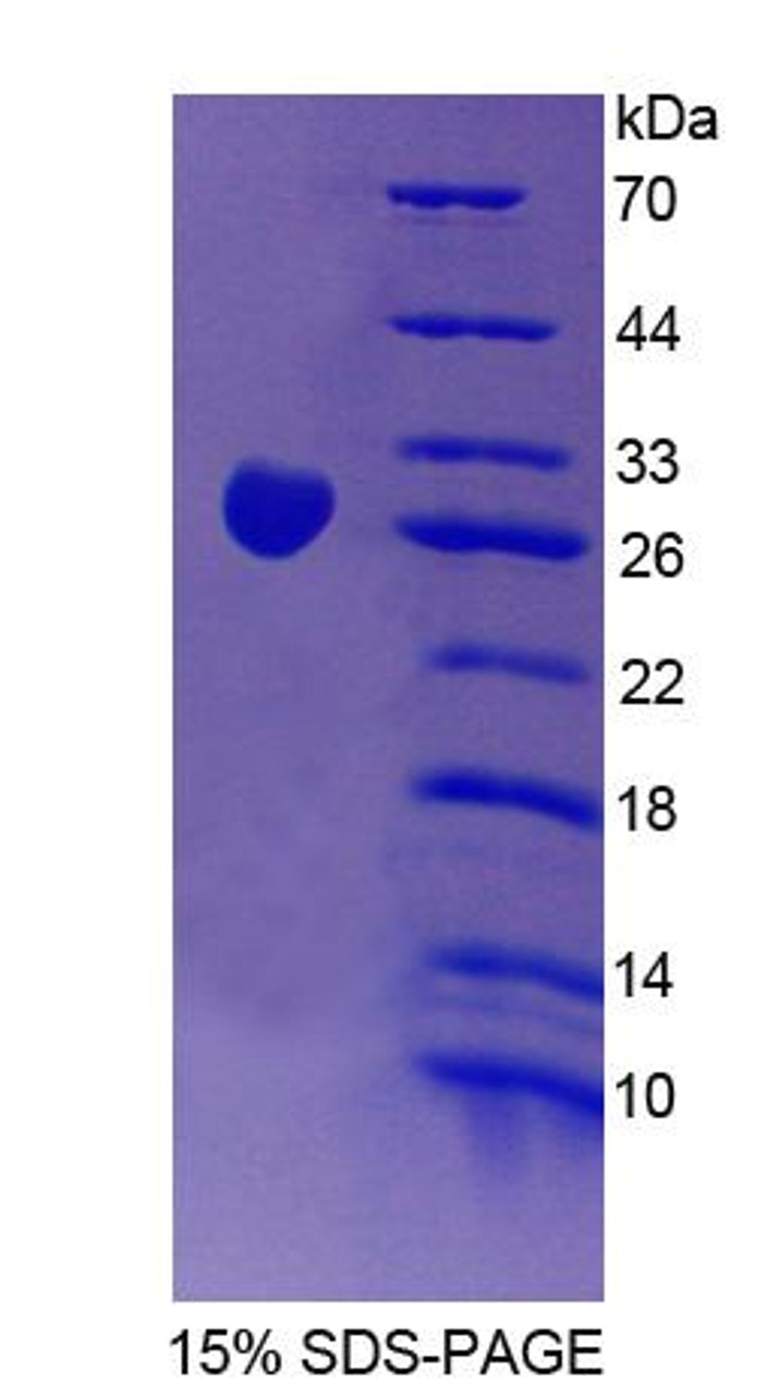 Mouse Recombinant Chimerin 2 (CHN2)