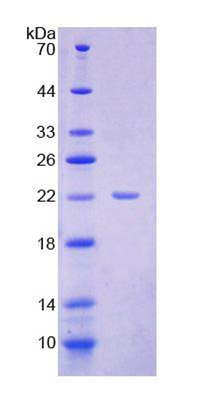 Human Recombinant Developmental Pluripotency Associated Protein 3 (DPPA3)