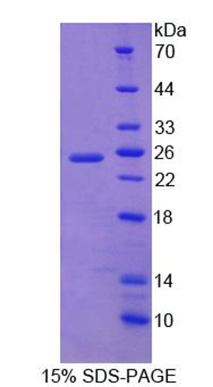 Mouse Recombinant Dystrobrevin Binding Protein 1 (DTNBP1)