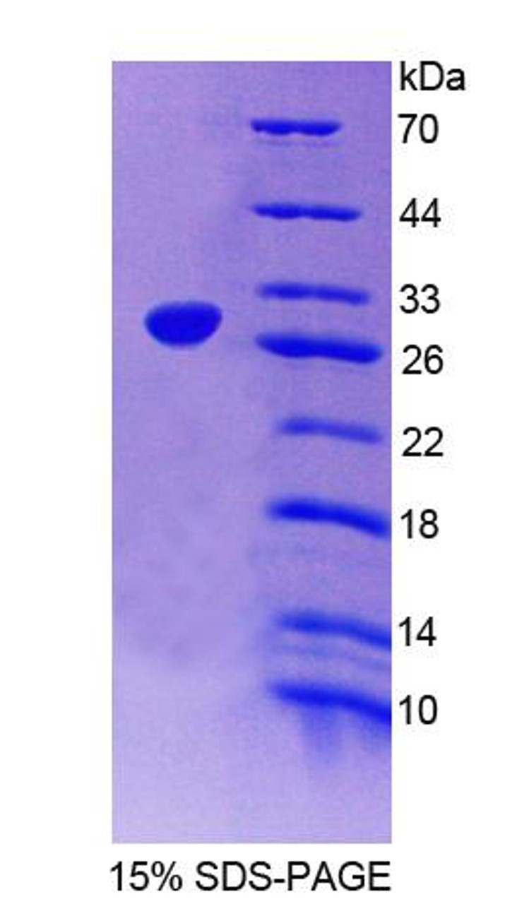 Mouse Recombinant Dyskerin (DKC)