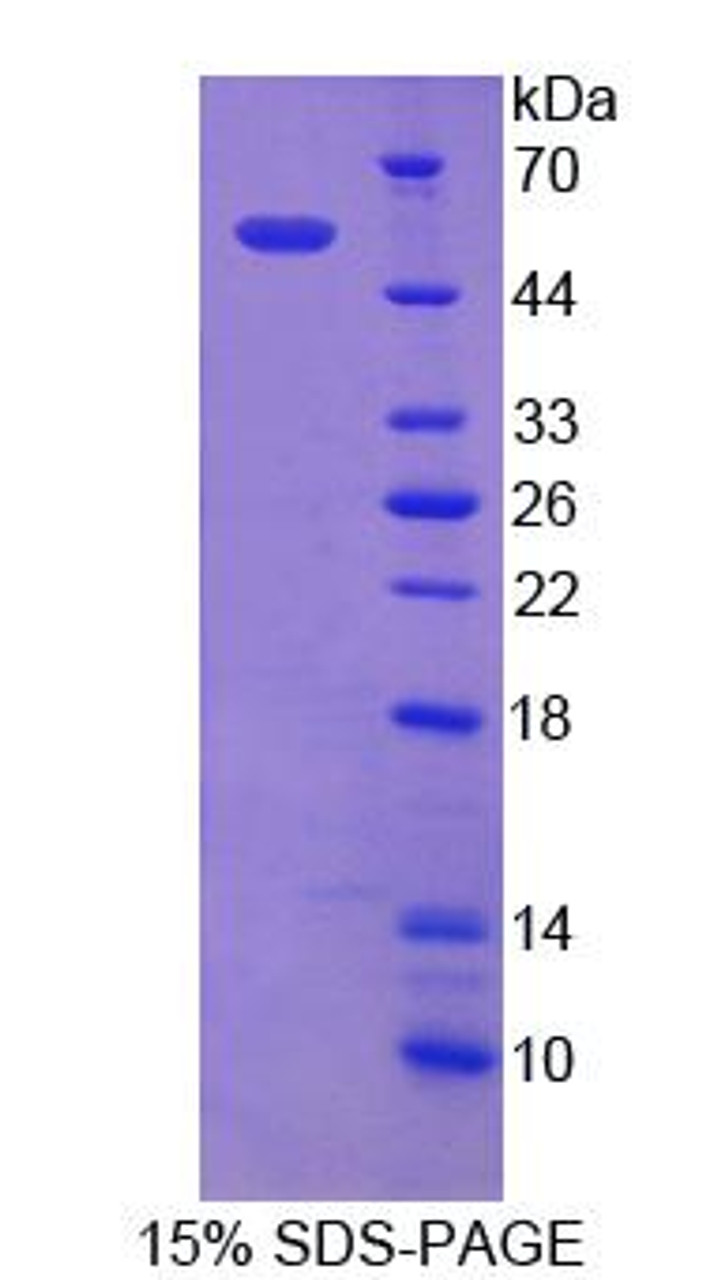 Mouse Recombinant Epithelial Cell Transforming Sequence 2 (ECT2)