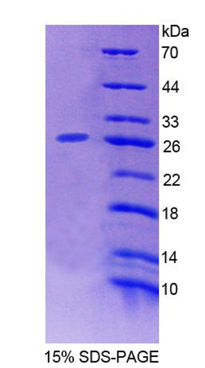 Mouse Recombinant Cytosolic Ovarian Carcinoma Antigen 1 (COVA1)