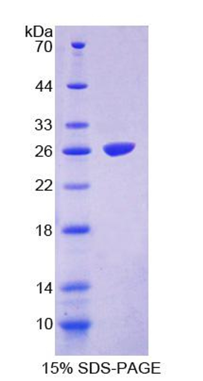 Human Recombinant Fas Activated Serine/Threonine Kinase (FASTK)