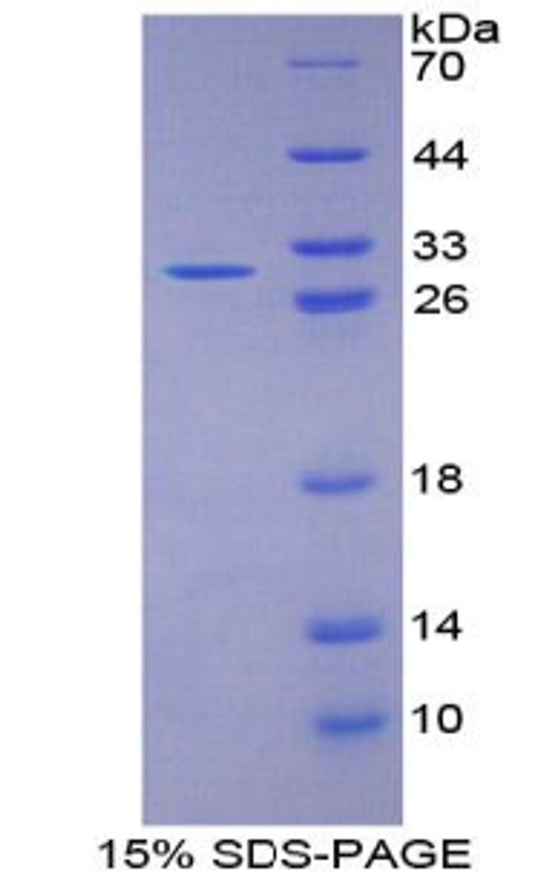 Human Recombinant Fibulin 1 (FBLN1)