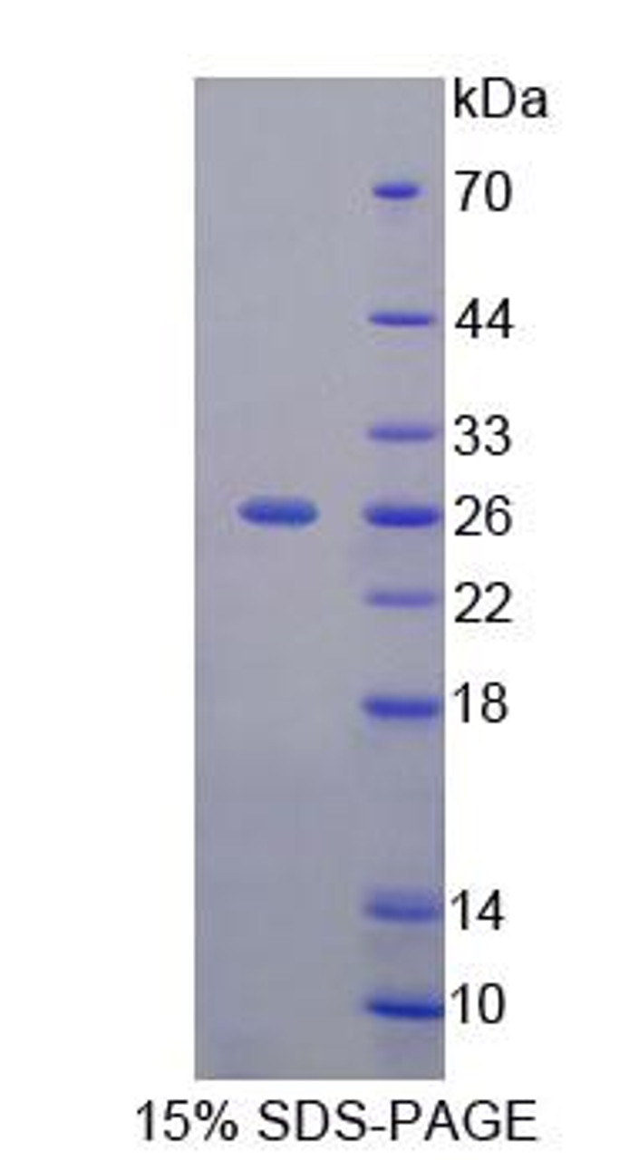 Human Recombinant Fibrosin (FBS)