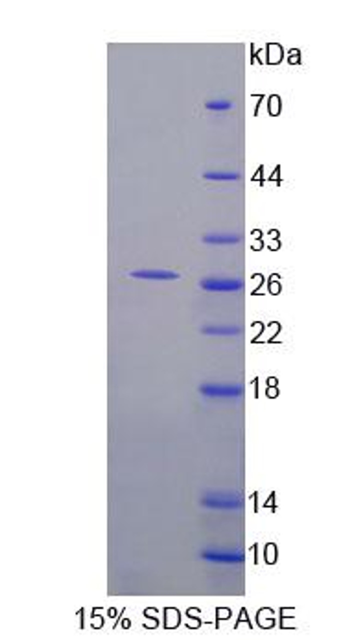 Mouse Recombinant Follicular Lymphoma Variant Translocation 1 (FVT1)