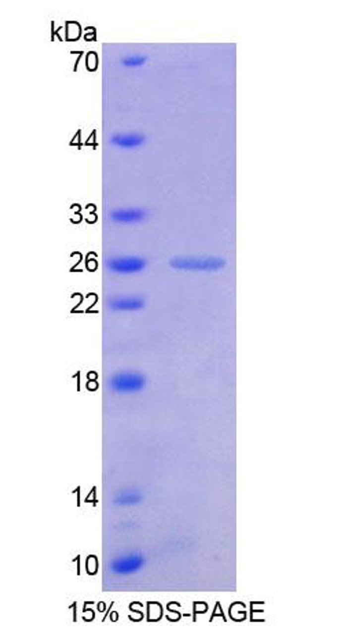 Human Recombinant Friend Leukemia Virus Integration 1 (FLI1)