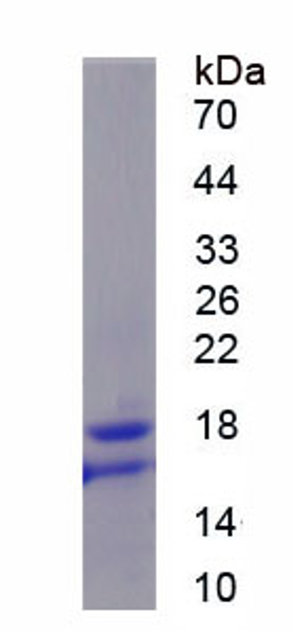 Mouse Recombinant Gastrokine 1 (GKN1)