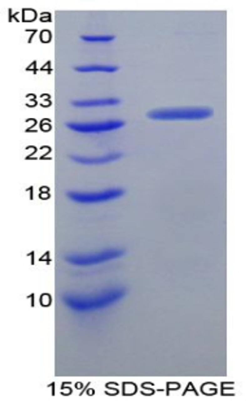 Mouse Recombinant Granulin (GRN)