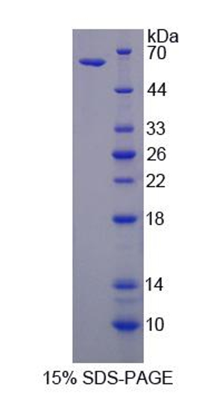 Human Recombinant Hemopoietic Cell Kinase (HCK)