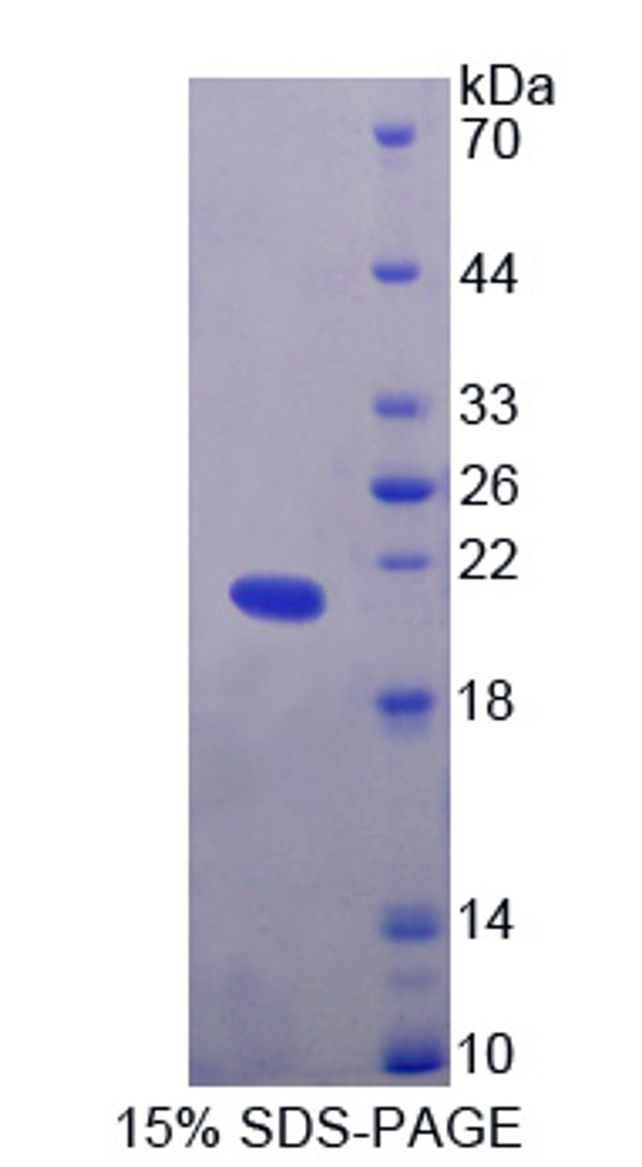 Human Recombinant Helicase Like Transcription Factor (HLTF)