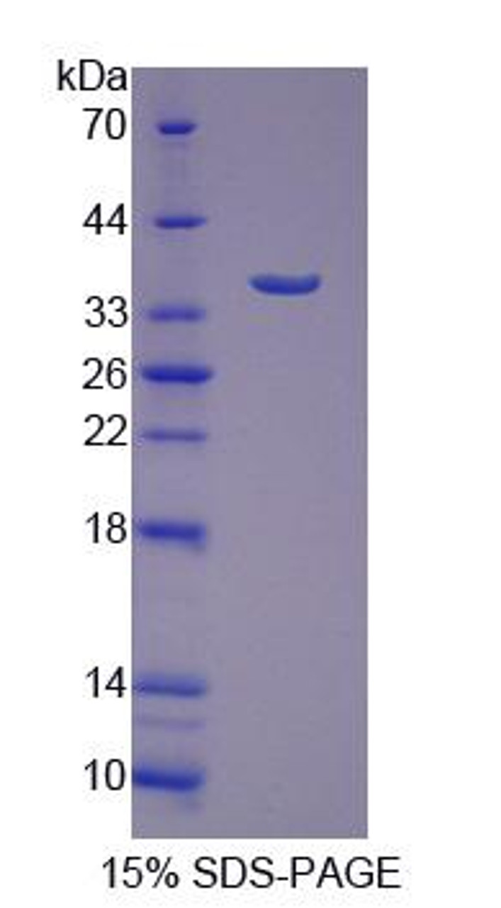 Human Recombinant Intestinal Cell Kinase (ICK)