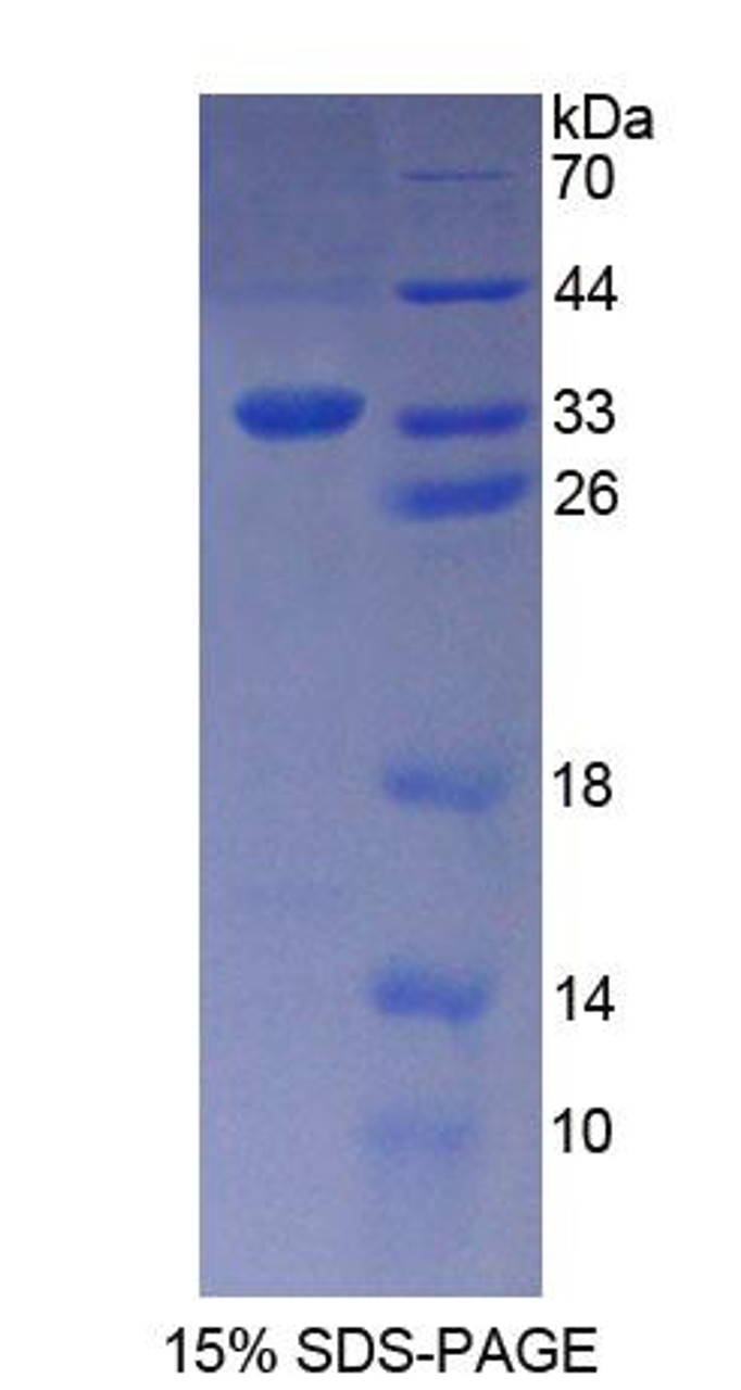 Human Recombinant Katanin P60 Subunit A 1 (KATNA1)