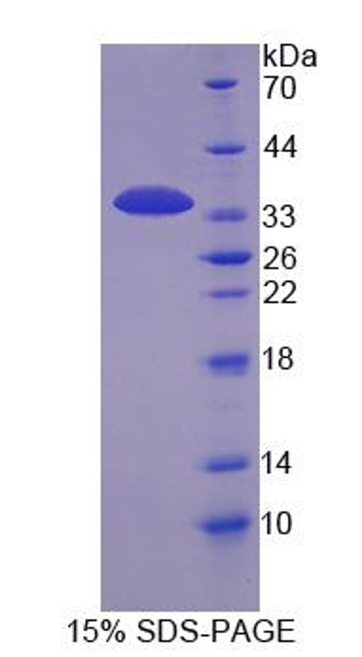 Cattle Recombinant Keratocan (KERA)