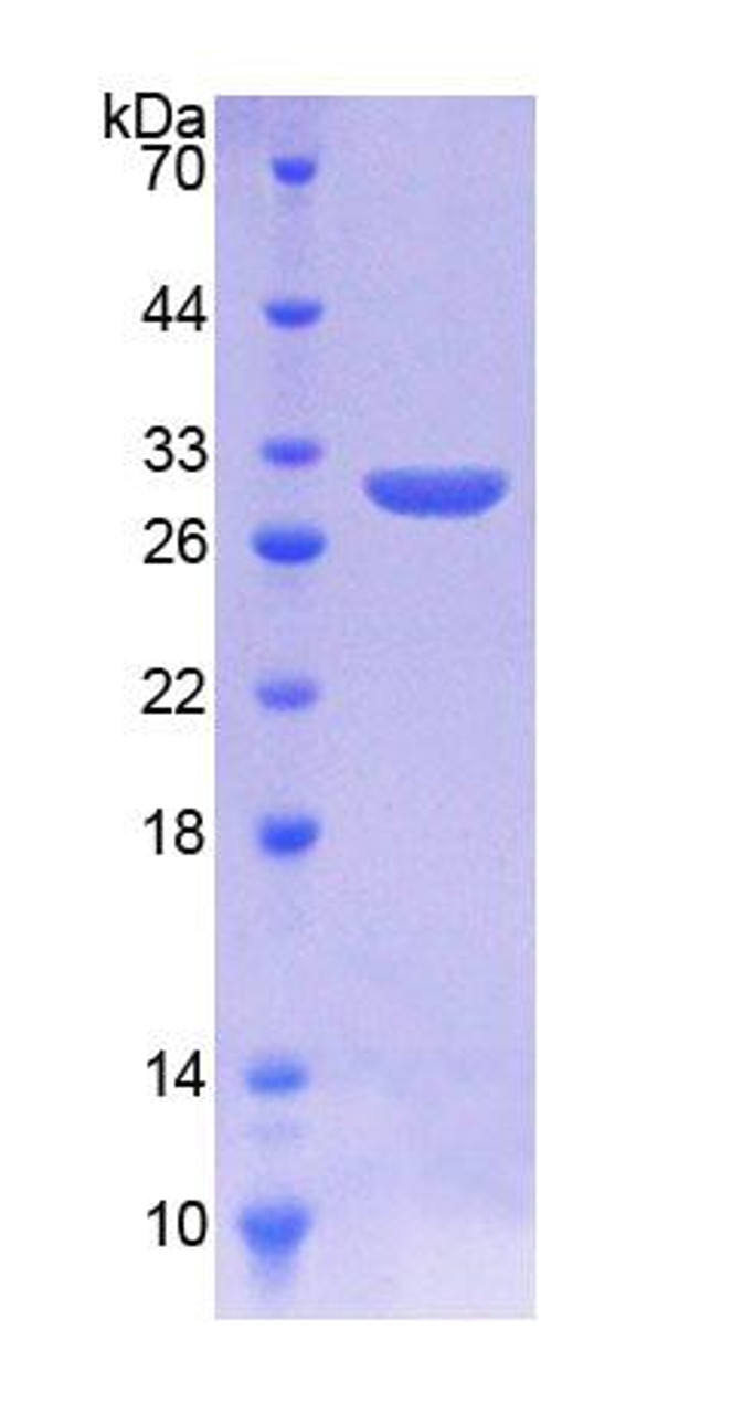 Human Recombinant Kringle Containing Transmembrane Protein 1 (KREMEN1)