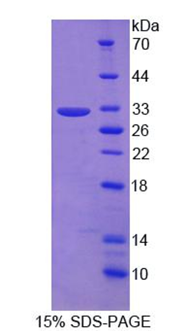 Mouse Recombinant Leucine Rich Repeats And Death Domain Containing Protein (LRDD)