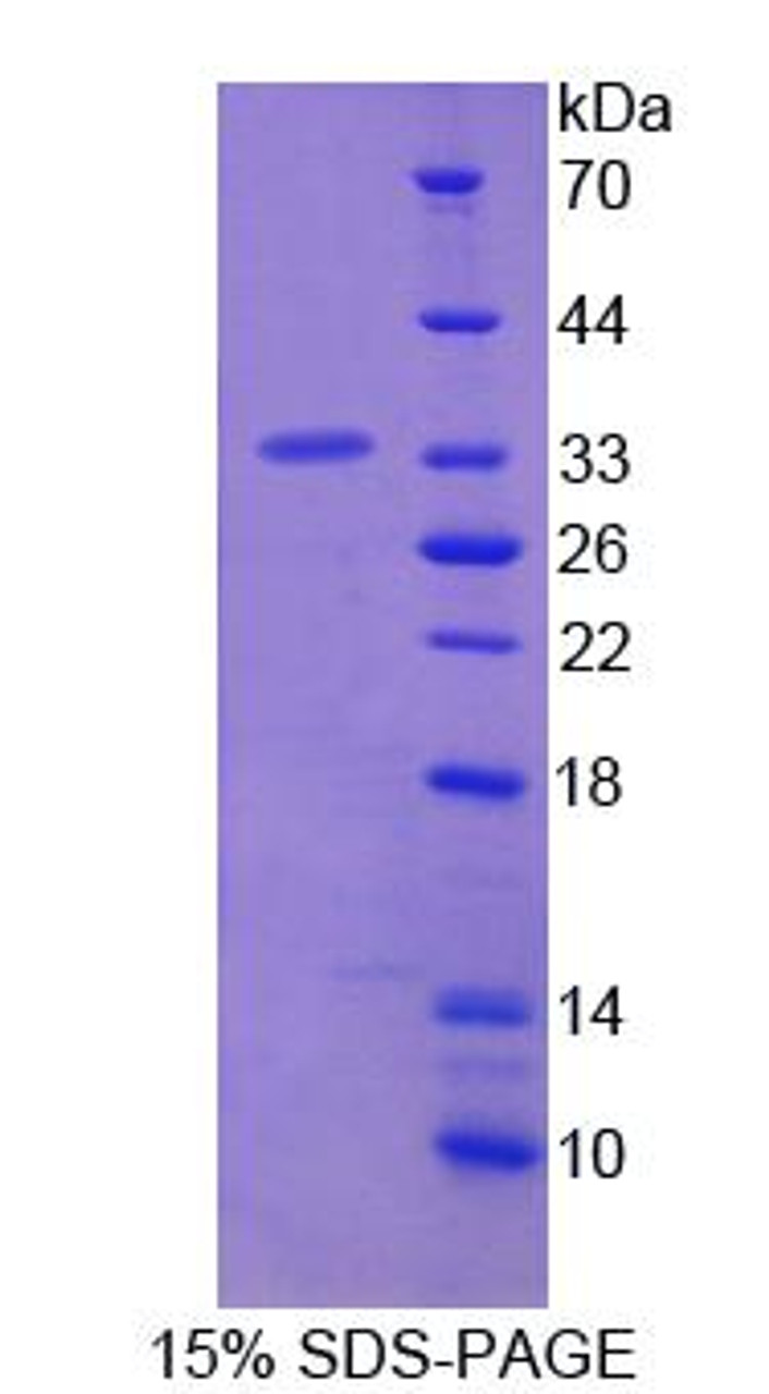 Mouse Recombinant Lymphocyte Specific Protein 1 (LSP1)