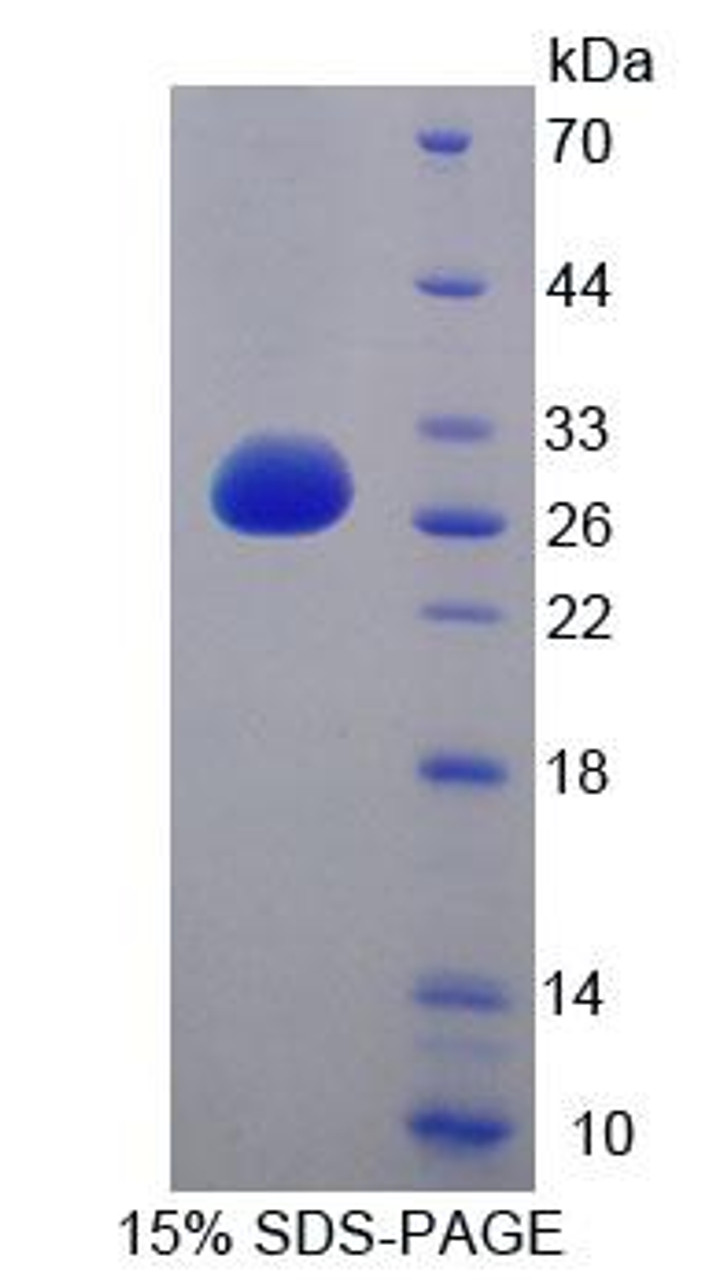 Human Recombinant Lysophospholipase I (LYPLA1)