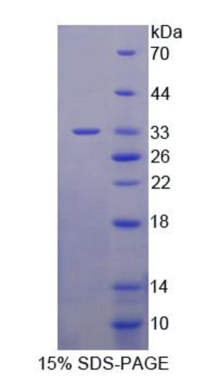 Human Recombinant Ureidopropionase Beta (UPb1)