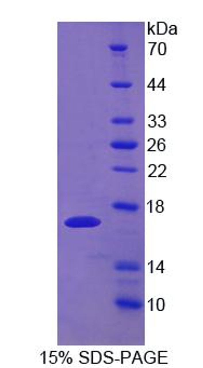 Mouse Recombinant Uroplakin 1A (UPK1A)