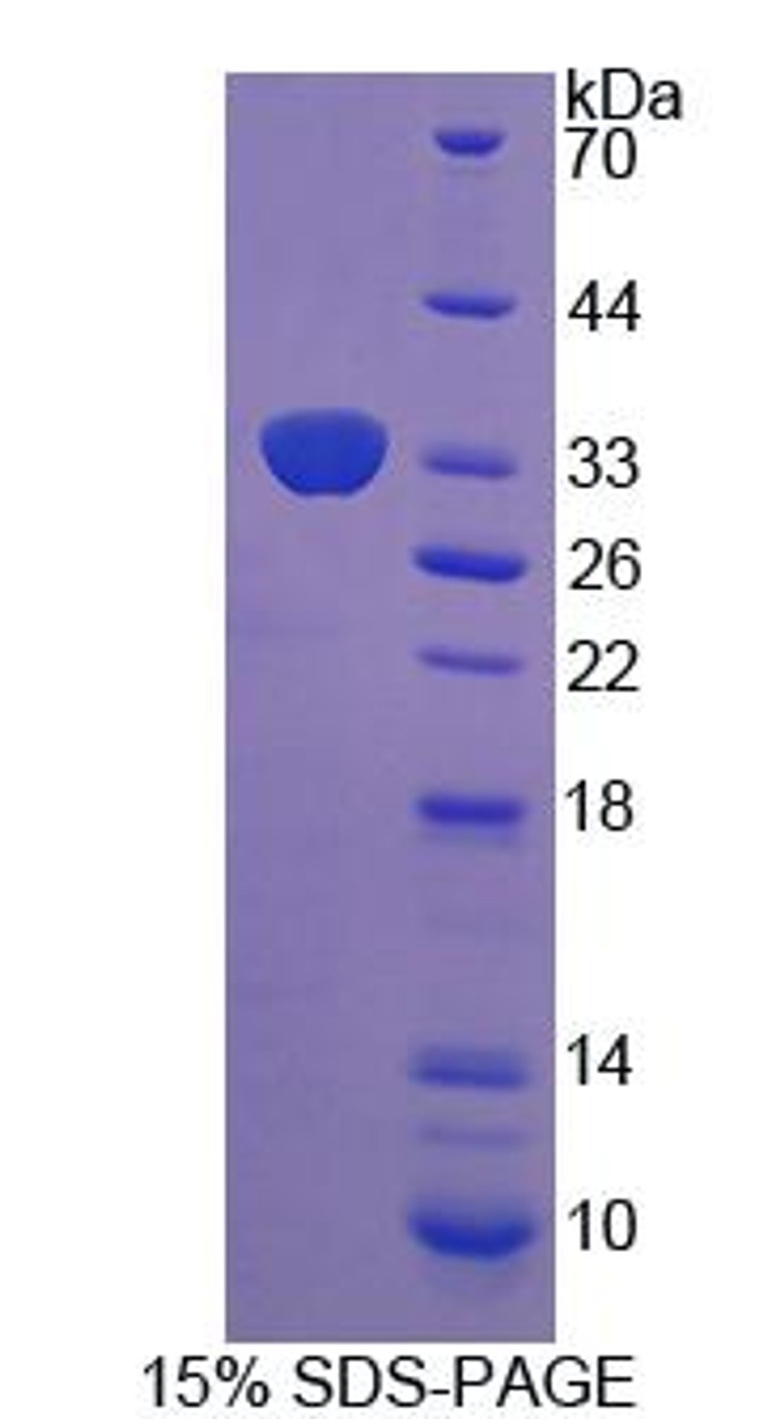 Mouse Recombinant Xylosyltransferase II (XYLT2)