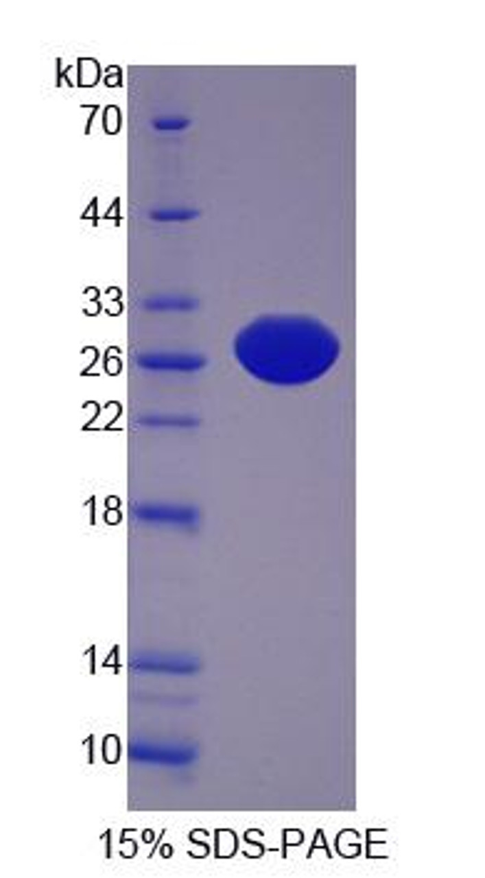 Cattle Recombinant Xanthine Dehydrogenase (XDH)