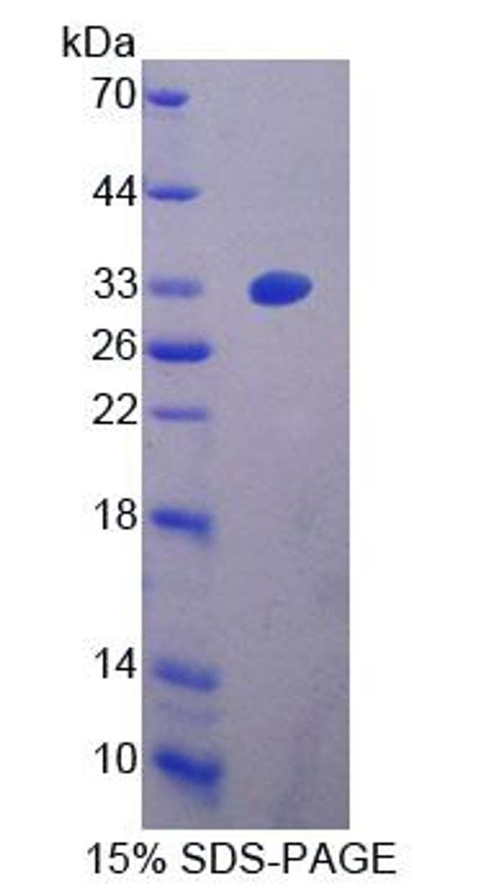 Mouse Recombinant Zuotin Related Factor 1 (ZRF1)