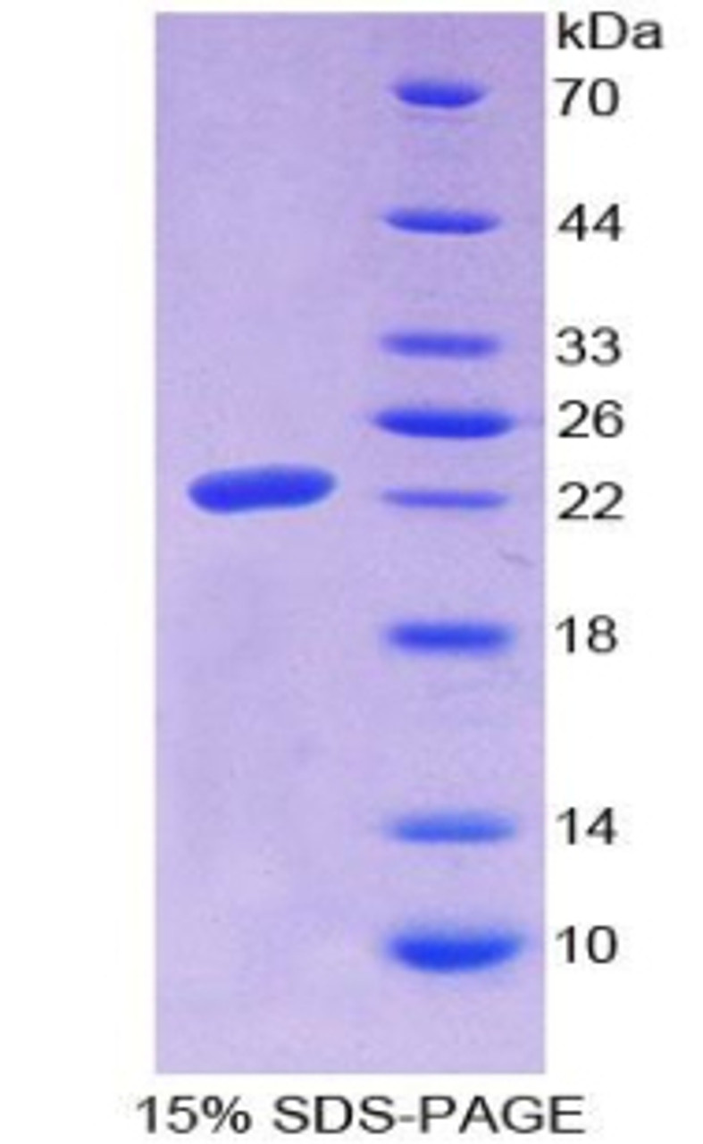 Human Recombinant Microfibrillar Associated Protein 2 (MFAP2)