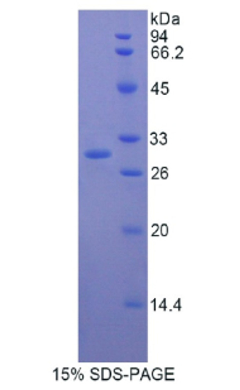 Human Recombinant Multimerin 1 (MMRN1)