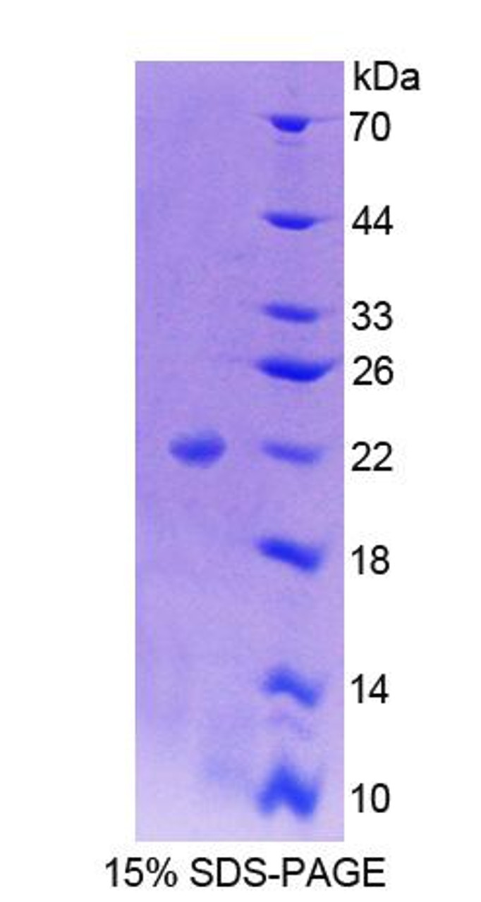 Human Recombinant Nuclear Factor I/A (NFIA)