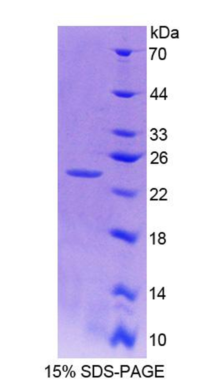 Mouse Recombinant Ninein (NIN)